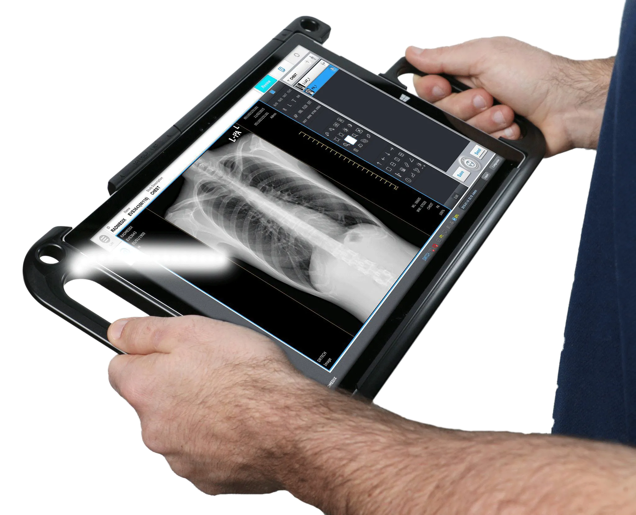 Acuity 10 x 12 Wireless Digital X-ray Gadox